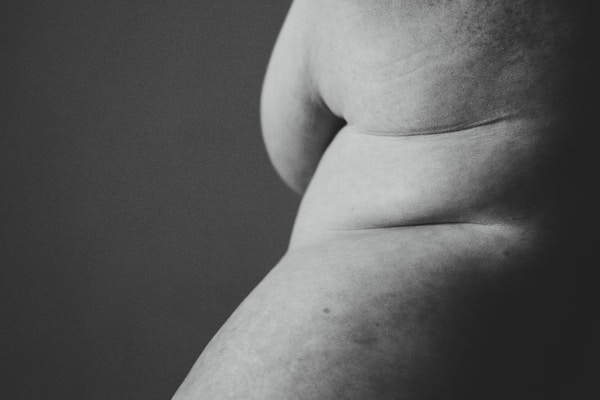 Folds of skin on the side of a woman's body. Photo by Annie Spratt on Unsplash
